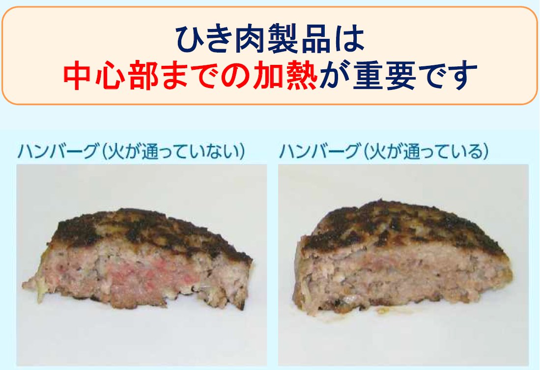 厚生労働省食品安全情報 V Twitter ひき肉製品 メンチカツ ハンバーグ等 もしっかり焼いて食べよう ひき肉製品は外側が焼けていても中は 生焼けの場合があり 腸管出血性大腸菌 O157等 による食中毒の原因となる危険性が ひき肉製品は中心部までしっかり加熱