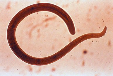 StopTB's tweet photo. Patients w/ #latentTB #threadworm co-infection have lowered immunity, greater risk of developing active TB.
https://t.co/0nTsI6xKci
#EndTB https://t.co/uZVEGkzjU5