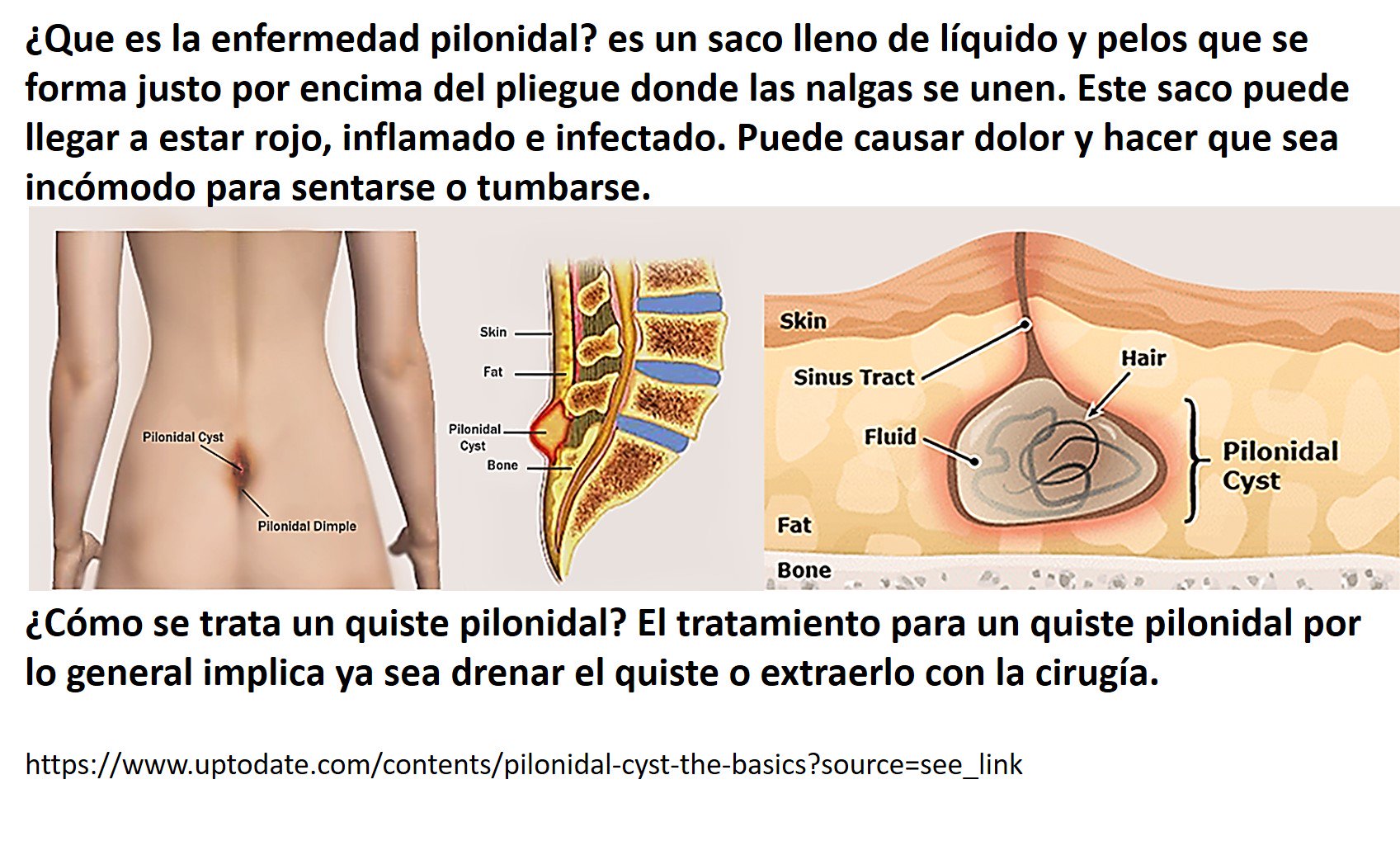 especialista linear unit tumor pilonidal