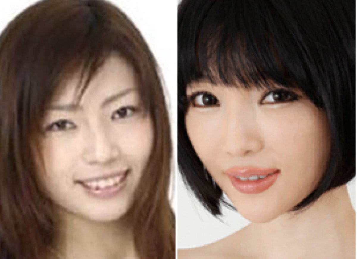 Naomi Auf Twitter 森下悠里 とか言う奴 目のクマと鼻と歯の整形はしたとか自白してるみたいだけど 二重 目頭切開 唇のボトックス 豊胸も全部やってるじゃん どうせならバレバレなんだから全部認めればいいのにw しかし整形し過ぎると可愛い Naomi Auf Twitter 森下悠里 とか言う奴 目のクマと鼻と歯の整形はしたとか自白してるみたいだけど 二重 目頭切開 唇のボトックス 豊胸も全部やってるじゃん どうせならバレバレなんだから全部認めればいいのにw しかし整形し過ぎると可愛い