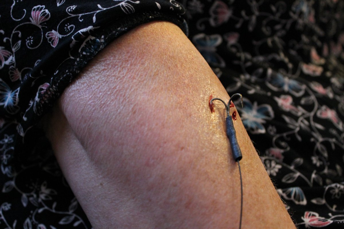 Rebecca Albrecht tweet media