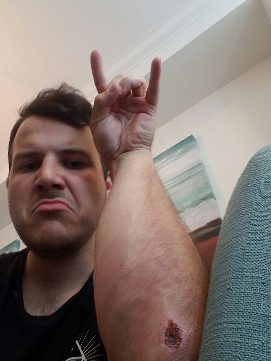 road rash scab road rash scab
