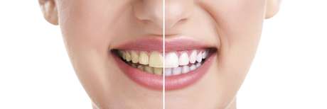 4 motivos principales por los que tus dientes están tan amarillos #TerraSaludBucal bit.ly/2tlRORQ