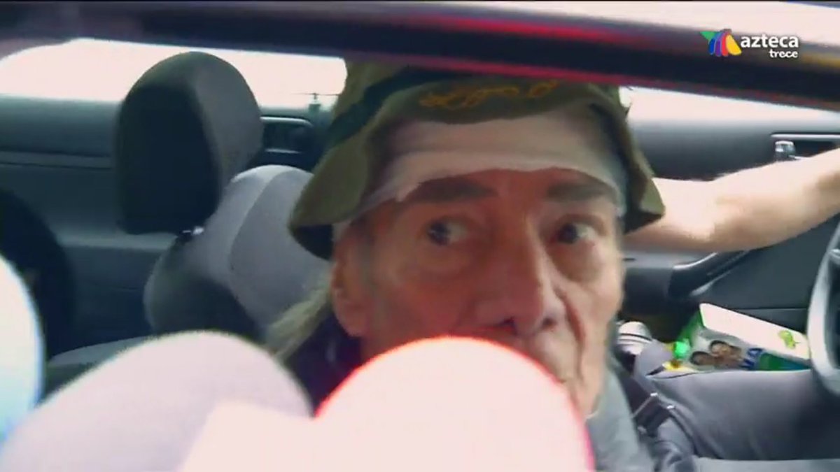 Manuel “El Loco” Valdés asistió a curación,necesita que cicatrice su herida para programar la cirugía de injerto piel #LoVisteEnVentaneando