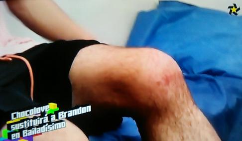 LizbthBM_'s tweet photo. Como va a bailar con la rodilla asi-.- !
#RecuperateBrandon :) https://t.co/yDjqmsRCZJ