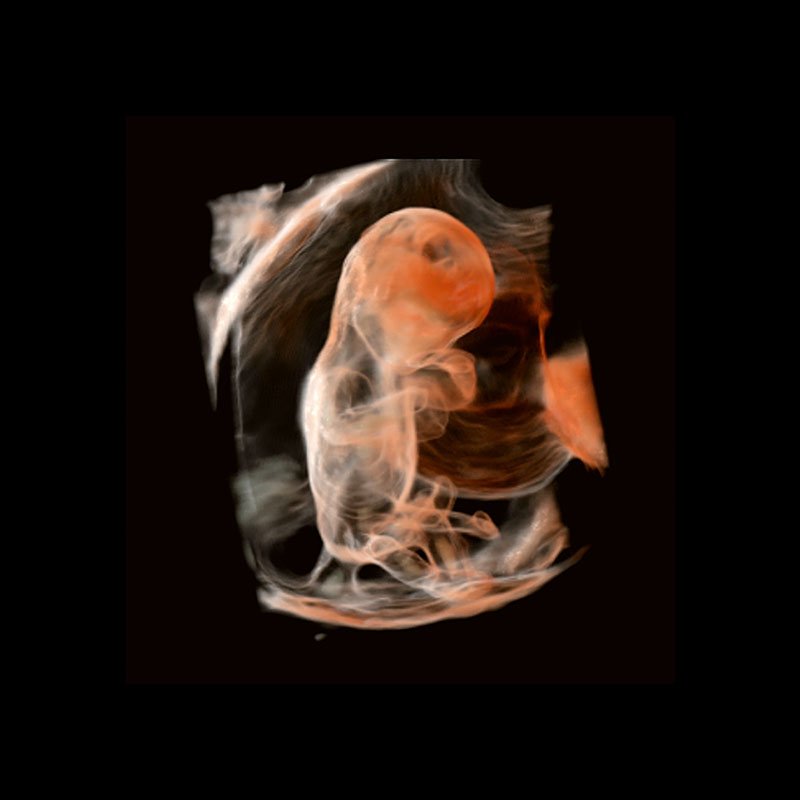 CanonMedicalANZ's tweet photo. Do we even need MRI [in foetal medicine] because the image quality on the #Aplio i-series is so good https://t.co/MPTfL7BH7y #qualityimaging https://t.co/olSQPlRt1h