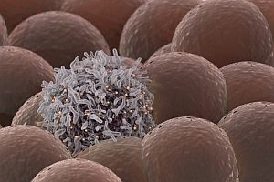 cellbankaus's tweet photo. Aus Nature paper shows that the genetic landscape in acral and mucosal melanoma is different from skin melanoma. https://t.co/4O748fzWrU https://t.co/l1dxlkVbMq
