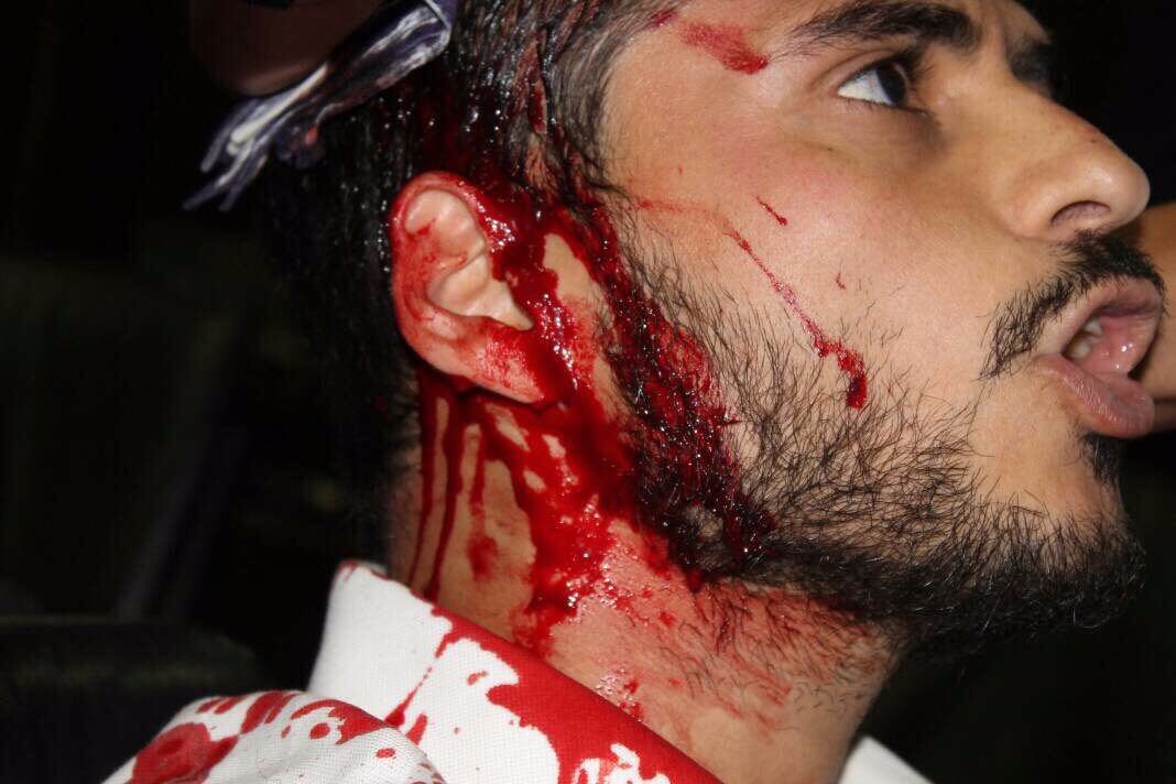 LesterToledo's tweet photo. Colectivos hirieron a nuestro hermano @ArmandoArmas. Así actúa la dictadura, con violencia y pasando por encima de quien está en su contra. https://t.co/QmS09Mhv53