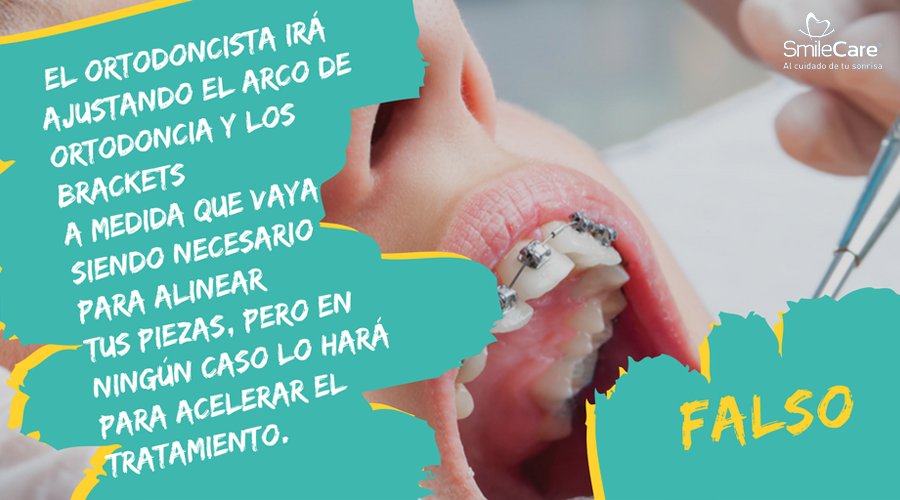 SmileCareMex's tweet photo. #MitoVerdad Cuanto más apretado este el arco de ortodoncia, más efecto hace. Deja tu salud dental en manos de #SmileCareMéxico https://t.co/zuPIq006iY