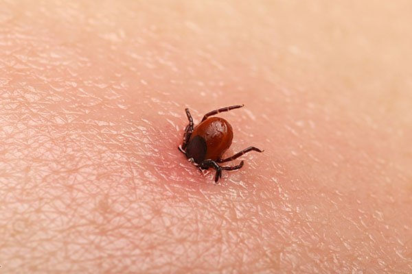 Coming up on the @MeehanCarolAnne show, Dr. Manisha Kulkarni on the risk of #LymeDisease in #Ottawa's west end. https://t.co/6fEjbOXj6W