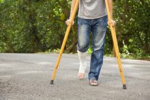 GDeanSolicitors's tweet photo. Can you claim for the cost of future treatment? https://t.co/48gPp1ie4x