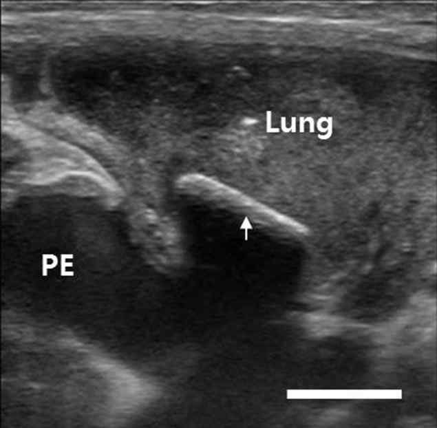 Albinovet's tweet image. #pyothorax induced by intrathoracic foreign body in a miniature dachshund: migration of popsicle stick from stomach goo.gl/vZfbAQ