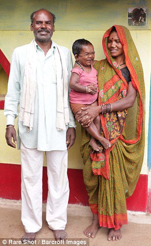Daily Mail Online on X: Indian man is only 29 inches tall after