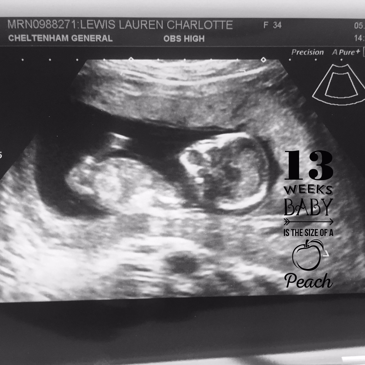 kimey83's tweet photo. Super excited to say baby Lewis is on the way and a globe trotter already 🌎✈️ #17weeks 😍👶🏼 https://t.co/EYupcHpa04