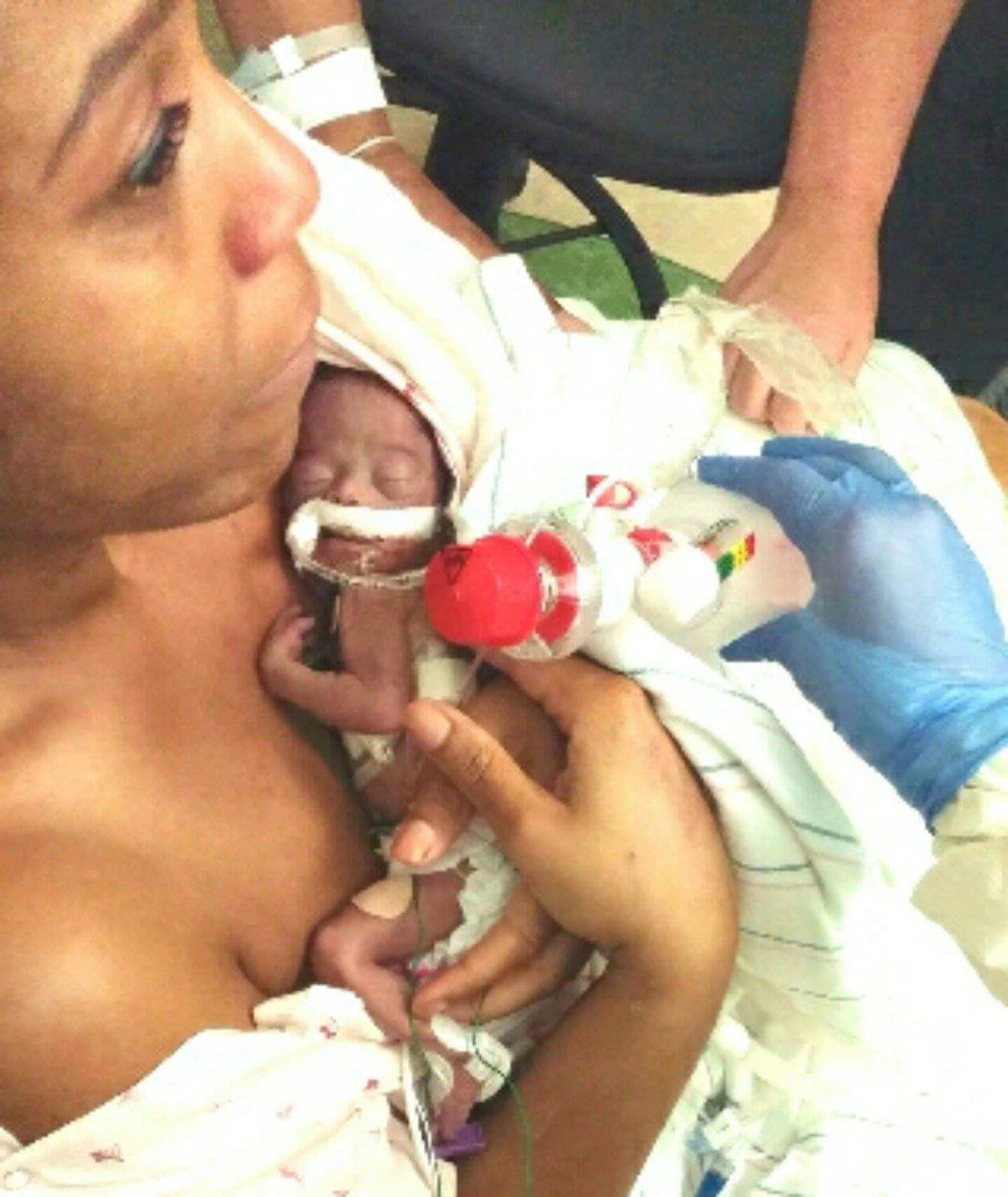 4BabySebastien's tweet photo. @CNN @Oprah @IyanlaVanzant @ACLU 
WashHospCenter killed my newborn. Punctured trachea, lacerated lungs, failed transfer to Children's. HELP https://t.co/kb08jaaE69