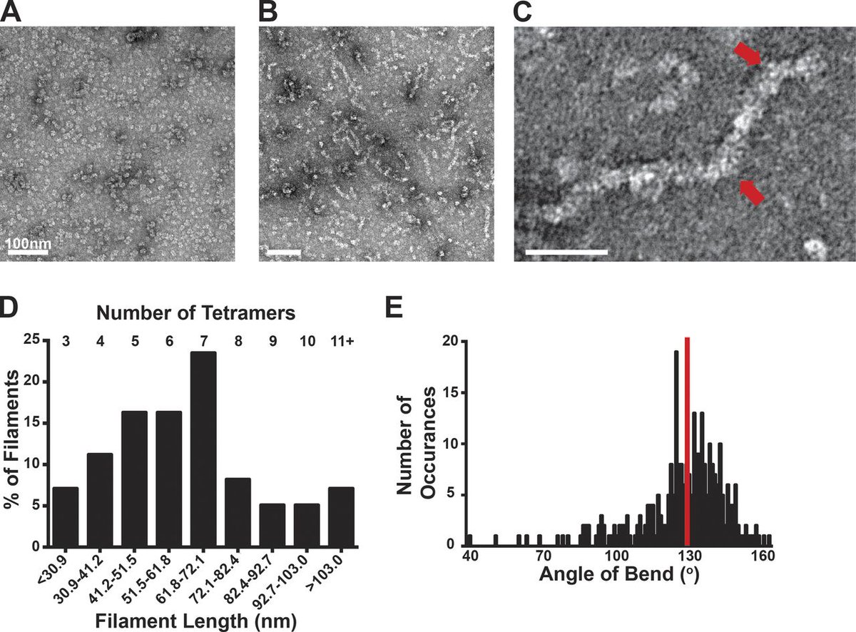 Journal of Cell Biology (@jcellbiol) on Twitter photo The glycolytic enzyme phosphofructokinase-1 assembles into filaments jcb.rupress.org/content/early/… <a href="/UCSF/">UC San Francisco</a> The glycolytic enzyme phosphofructokinase-1 assembles into filaments jcb.rupress.org/content/early/… <a href="/UCSF/">UC San Francisco</a>