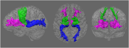 EdinUniLBC's tweet photo. Does resilience to stress have correlates in the brain? @heathersibley99 presents data on differences in white matter connections to #STRADL https://t.co/eIAs590whz