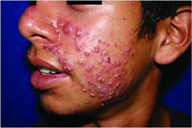 SE NÃO DER RT,AO AMANHECER IRÁ ESTÁ COM SEU ROSTO ASSIM!