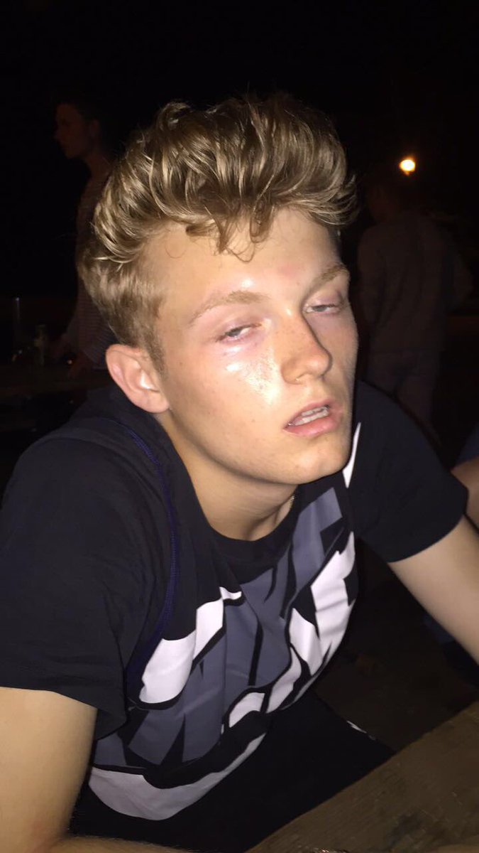 GoldblattMarco's tweet photo. #howhighareyouchallenge take a picture of a friend who's high af. Bent you can't top this one. https://t.co/gWiatuDWZL
