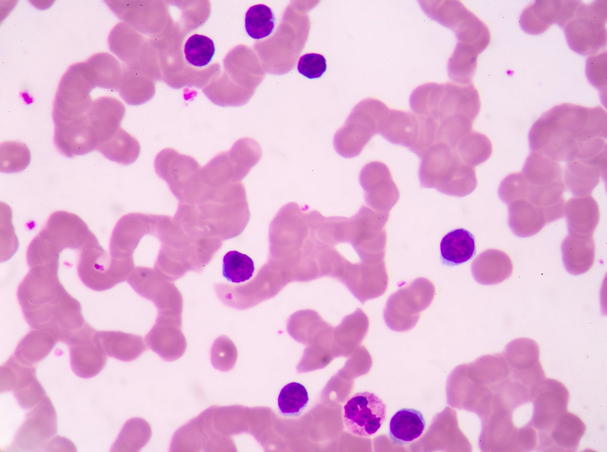 Third gene imparting resistance to last resort antibiotic colistin discovered goo.gl/1UgkLz #AntimicrobialResistance