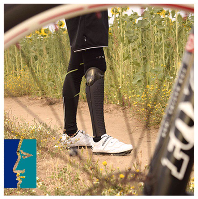 unyq's tweet photo. @ideo_ortopedias, #UNYQclinic in Seville (Spain) #unyq #prostheticcovers With Jaime & his #UNYQForge. #prostheticleg #amputee #amputeestrong https://t.co/Nr8cJ0xB6w