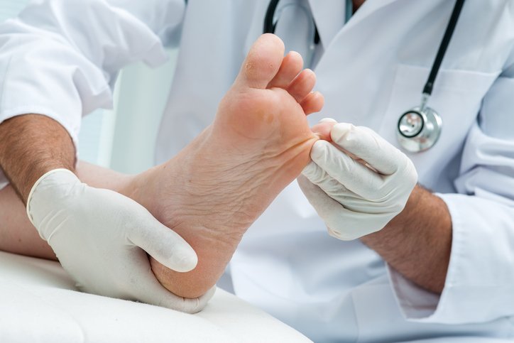 midtownpodiatry's tweet photo. Walking barefoot can cause plantar warts, a virus that enters through a cut. Watch out! https://t.co/P15puKpyj1