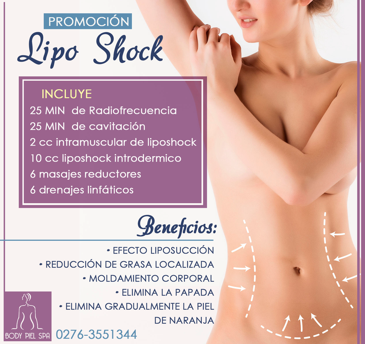 BodyPiel's tweet photo. Para apartar su cita deben comunicarse al 0276-3551344 https://t.co/utbQdk6oCw
