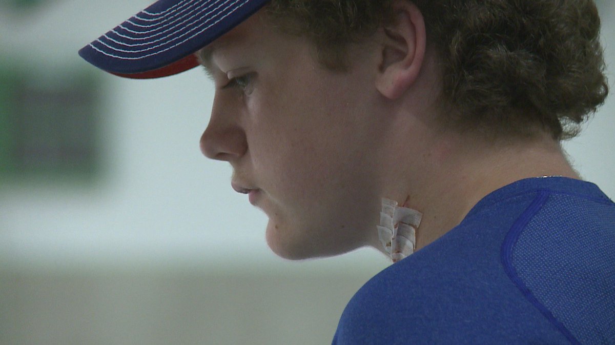 IvoryHecker's tweet photo. A high school hockey player survived life threatening injury when his teammate's skate sliced open his jugular vein in Edina. His story at 6 https://t.co/e50s5Xckqt