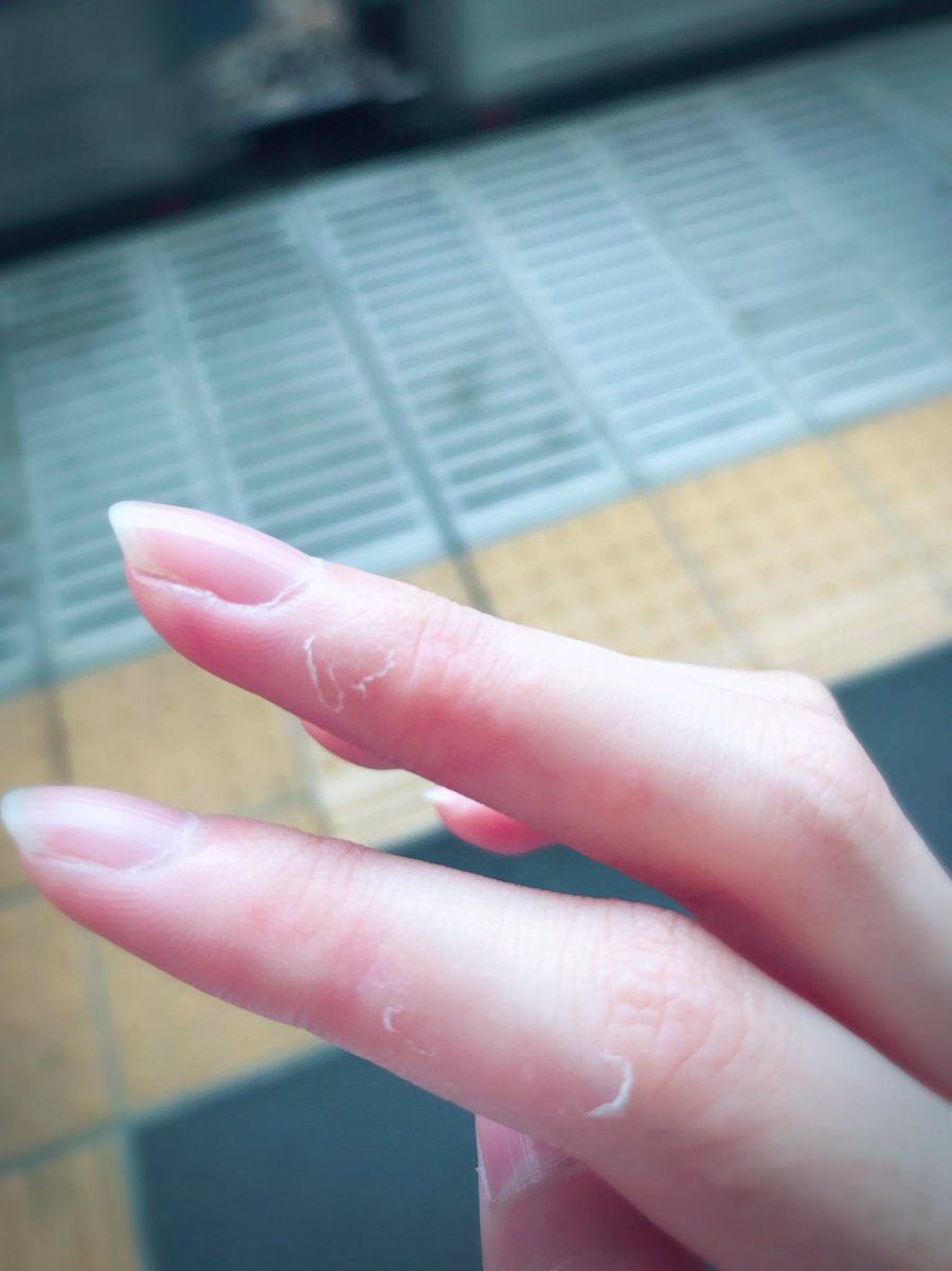 指 の 皮 が 剥ける 足の指の皮がむける原因と対処法6つ Amp Petmd Com