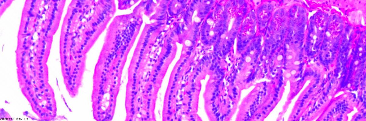 A new compound could provide nontoxic therapies for colorectal cancer. Read the research in <a href="/SciSignal/">Science Signaling</a>: scim.ag/2tmnCFF
