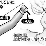本末転倒？歯科器具の使い回しにより歯やそれ以外の病気のリスクも負う可能性!
