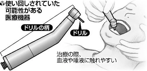 本末転倒？歯科器具の使い回しにより歯やそれ以外の病気のリスクも負う可能性！