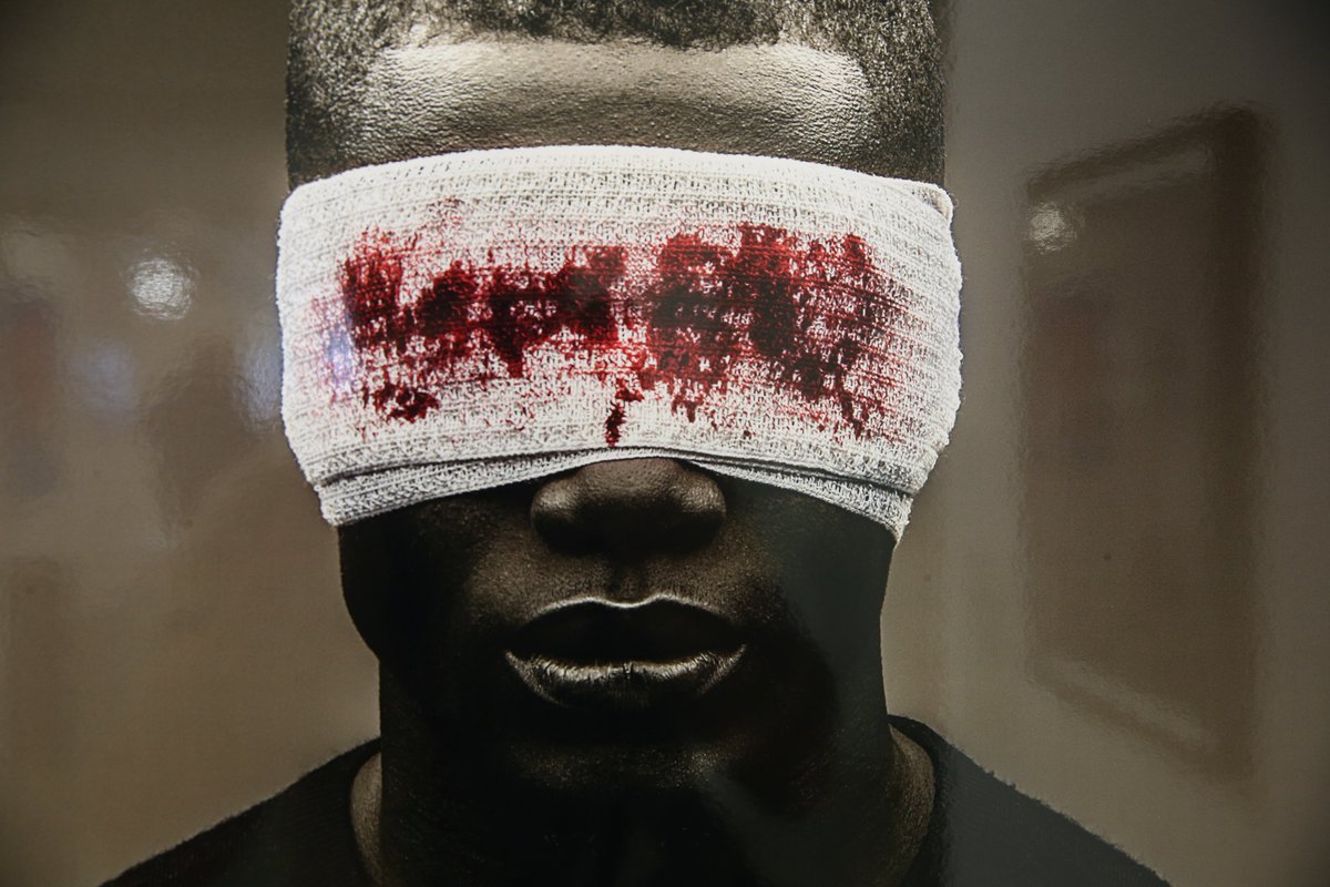Neo Natalie Gilder removes the blindfolds of depression #AfricanMenHurtToo #UnObscura #photography <a href="/LuxAuraExhibit/">Lux-Aura Exhibition</a> @FreeRange @TrumanBrewery