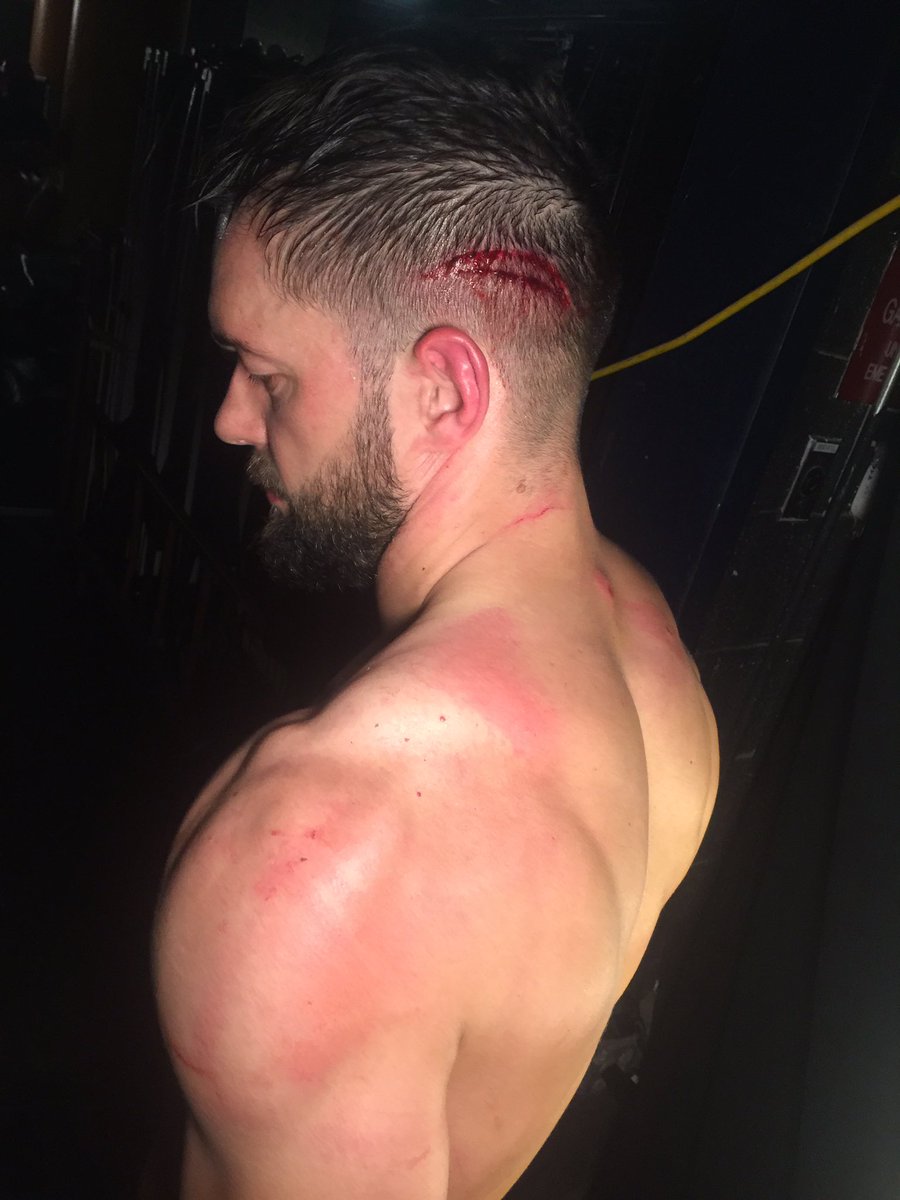 WWE's Finn Bálor Shows Off New Look