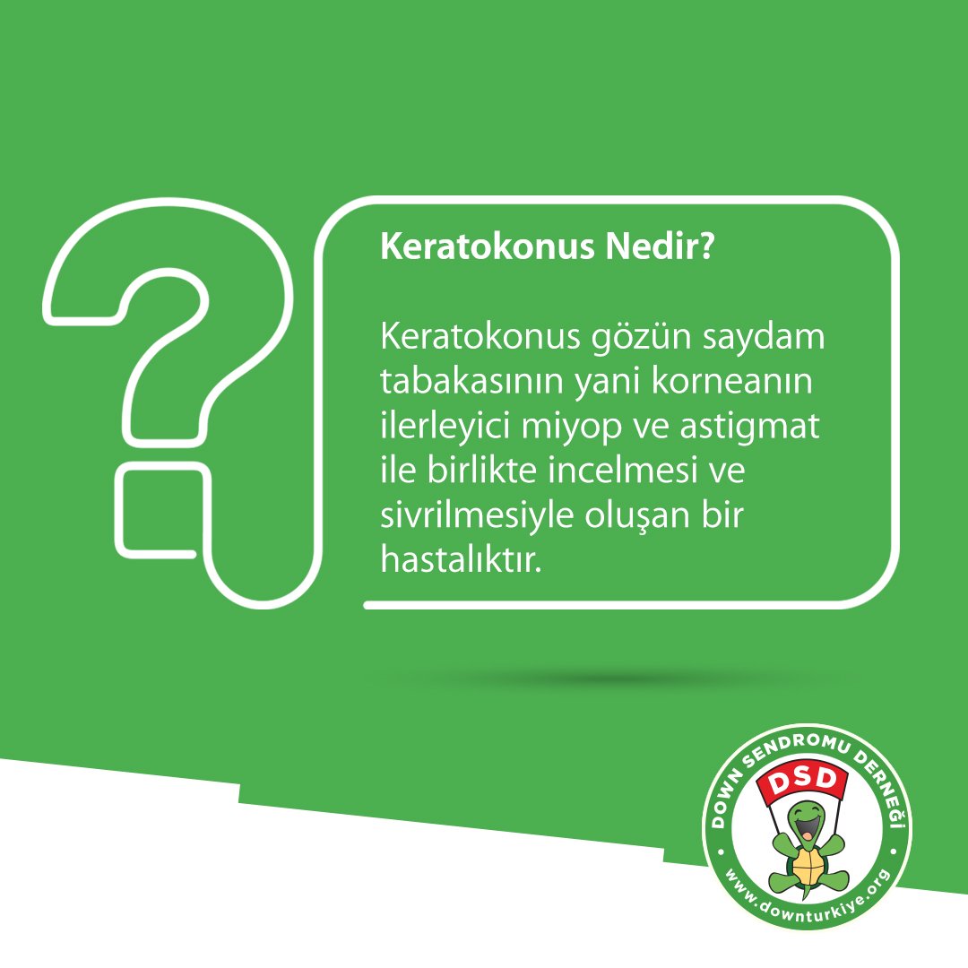 Down sendromlu bireyler doğuştan gelen fizyolojik sebeplerden kaynaklı keratokonus hastalığı için büyük risk grubunda yer almaktadır.