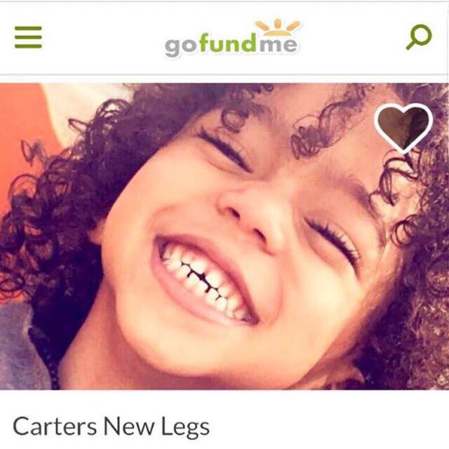 Gabs50Zakuani's tweet photo. ❗️PLEASE RT❗️PLEASE READ❗️please read Carters story and help in anyway you can by sharing
https://t.co/kY7pE741D6
#CartersNewLegs RT ❤️ https://t.co/q7gaL2Y2a0