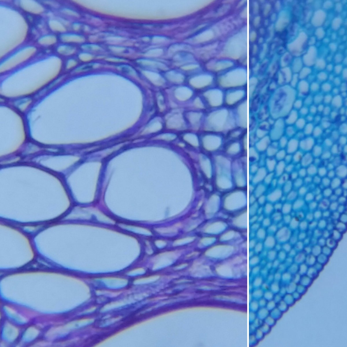 blipslens's tweet photo. #microscopy #smartphonemicroscope #stem #stemofpumpkin #plants #Blips #BlipsLens #Ultralabkit #Magnifytheworld https://t.co/UTZDMTMepU