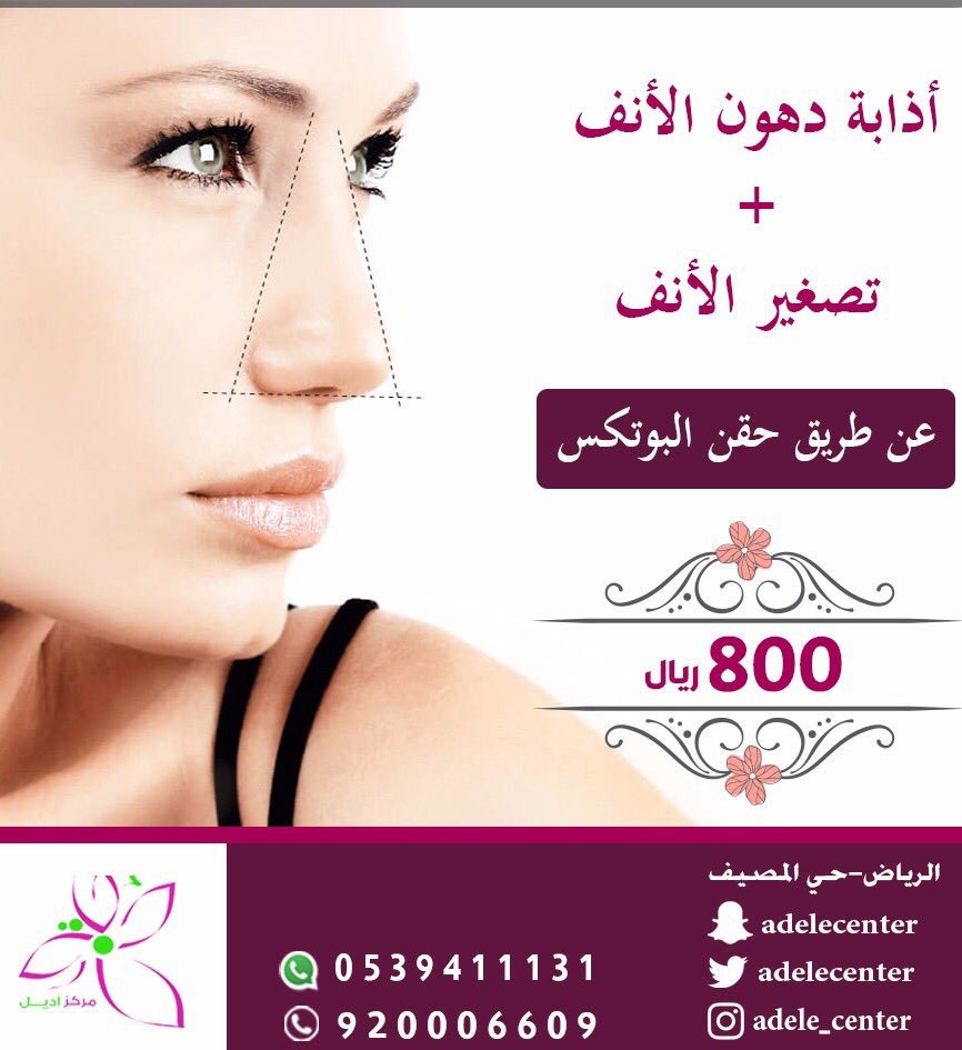 مجمع أديل الطبي בטוויטר خدمة إذابة دهون الأنف تصغير الأنف من مركز أديل للحجز والأستفسار 920006609 0539411131 الرياض حي المصيف Https T Co Lgljmlkorz