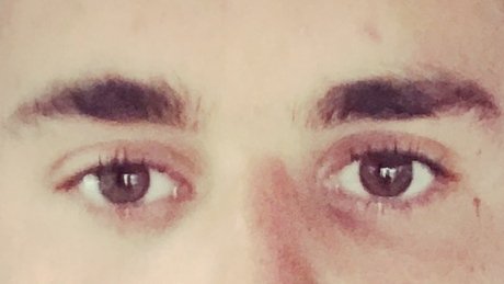 RT <a href="/CBCHealth/">CBC Health News</a>: Pink eye needs 'to run course' ophthalmologists advise against antibiotics ift.tt/2tsrnHt