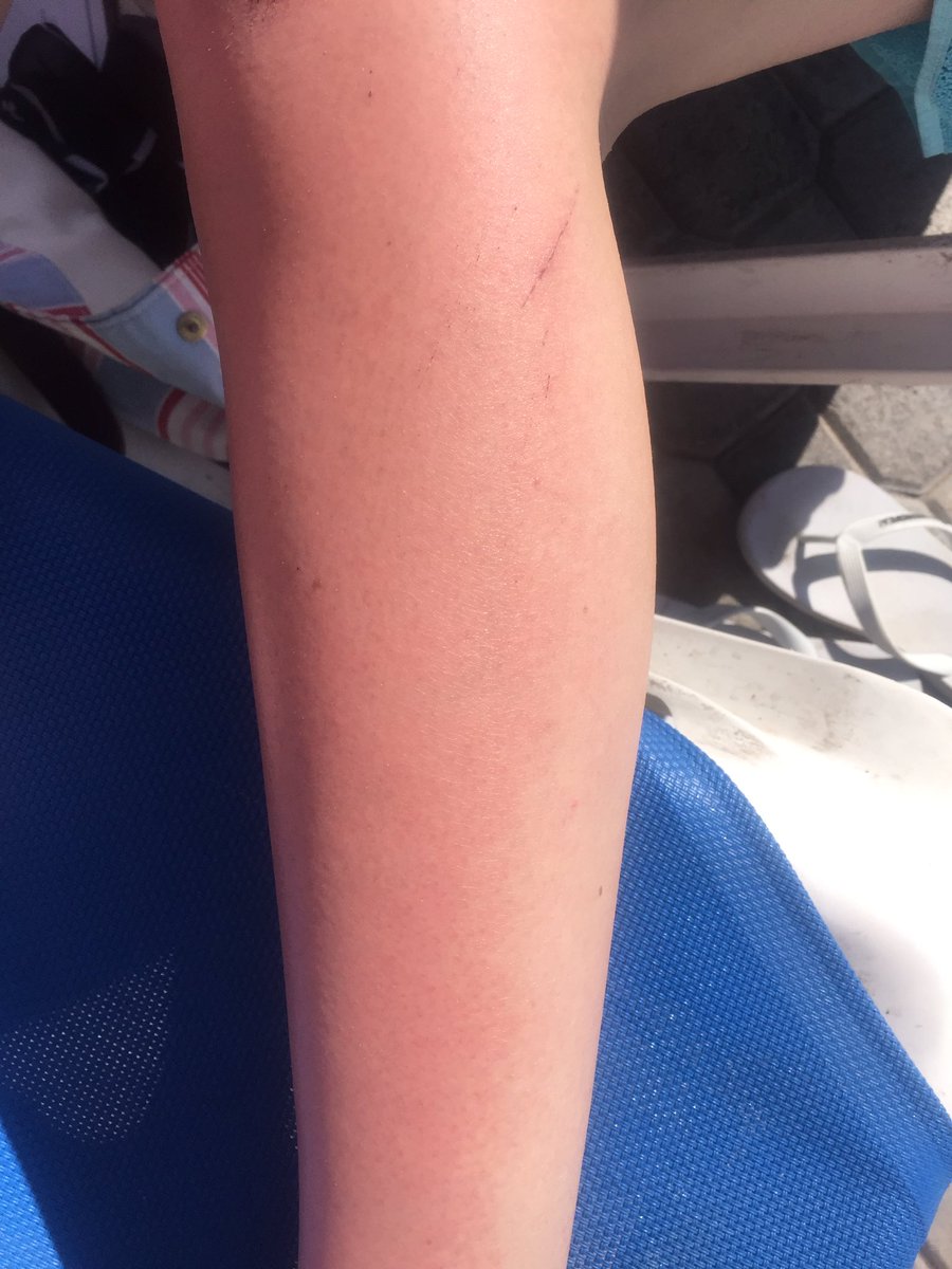 Royapxx's tweet photo. "You look like a strawberry and vanilla petits  filous" #britsabroad https://t.co/EGE2pVBFtO