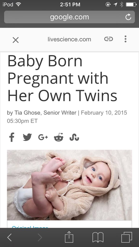 Baby Born 'Pregnant' With Her Own Twins