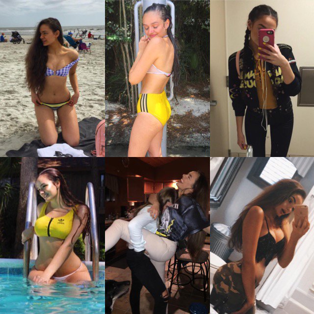 sascharichards's tweet photo. fuck you, anorexia :) https://t.co/86NHQAPBqJ