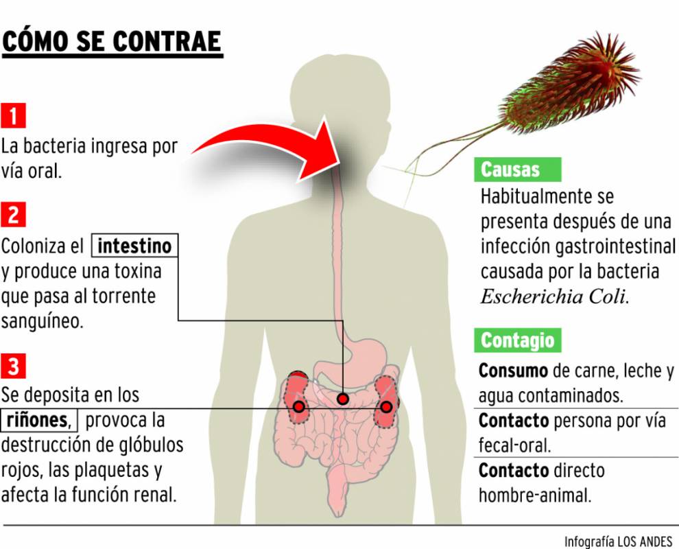 La bacteria e coli se contagia de persona a persona