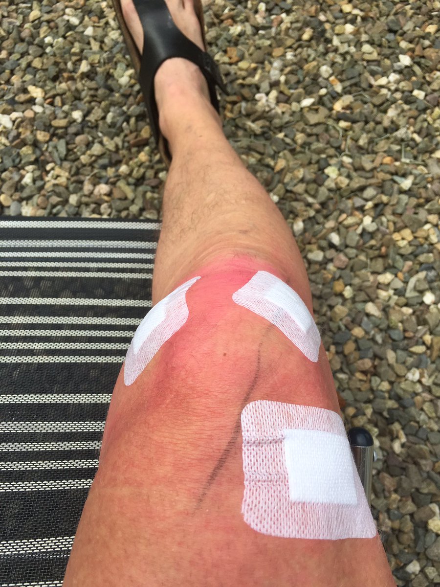 Gister kijk operatie gehad!!nu lekker rusten in het zonnetje!