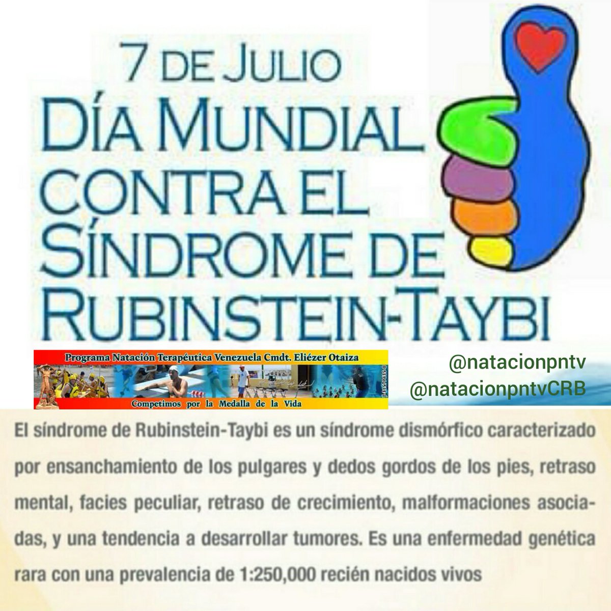 Día Mundial del Síndrome de Rubinstein Taybi