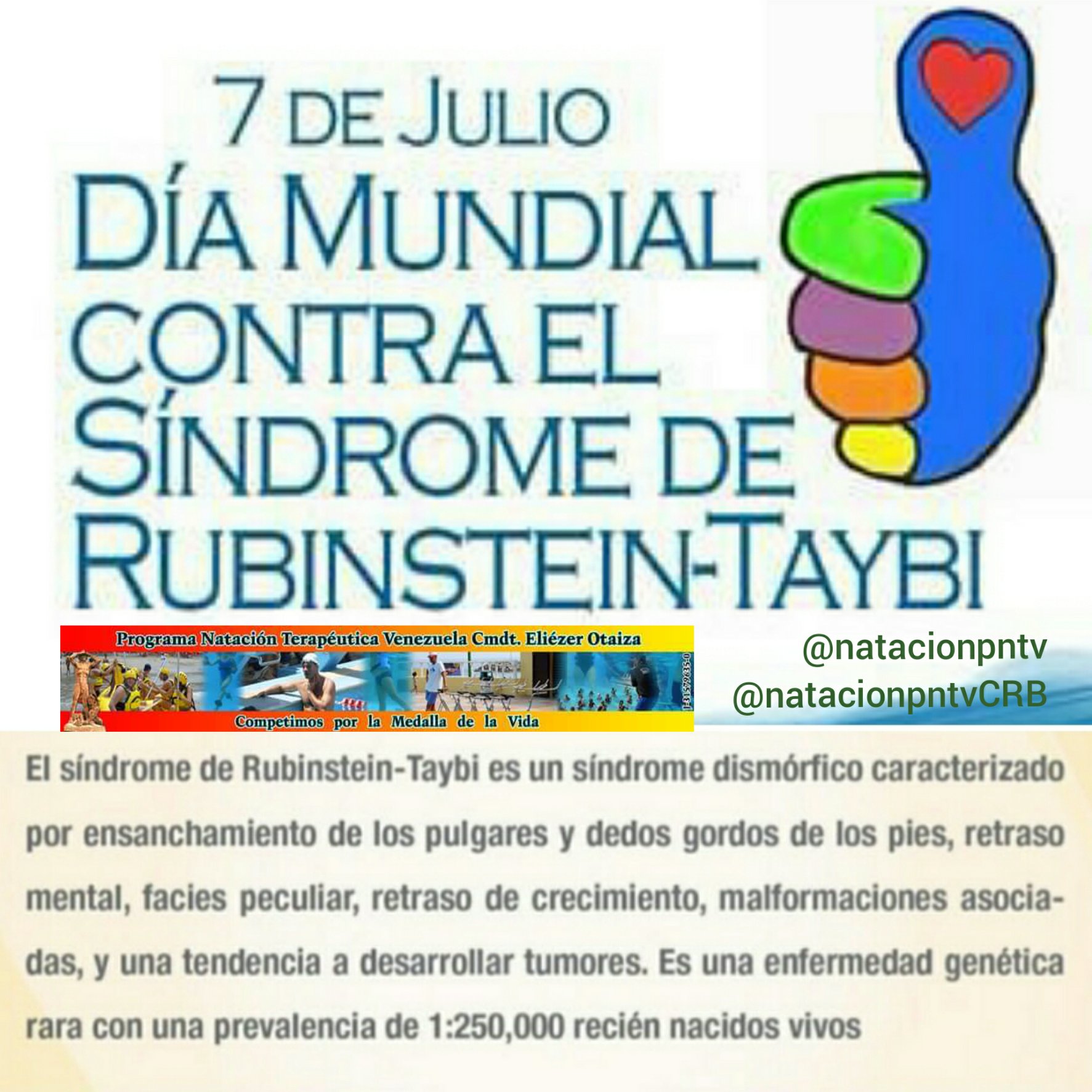 7 de julio: Día Mundial contra el Síndrome de Rubinstein-Taybi. – Noticias  Digital58