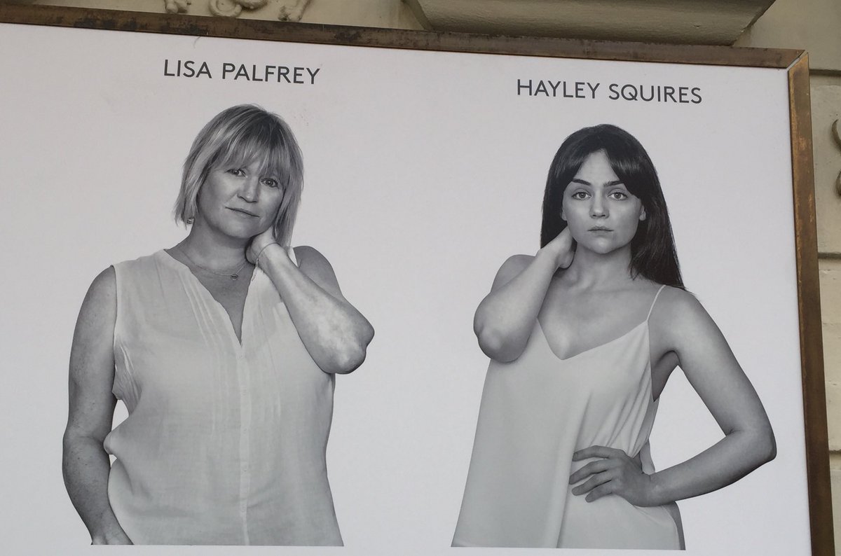 alaknights's tweet image. Why do all the female cast members of #CatOnAHotTinRoof have sore necks?!