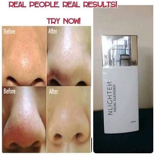 joyli2wayco's tweet photo. FACIAL CLEANSER
Helps refine pores for a finer complexion.
Make it happen
#Be_Nlighten
Info? 09164907045
#Follow me https://t.co/PFLTv9BI9h