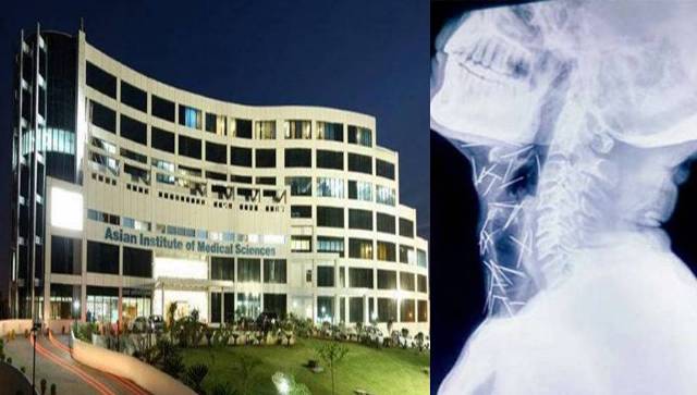 GHMSNNews's tweet image. #Rajasthan #PinMan #Hosspital #record ‘पिन मैन’ के शरीर से 90 पिन निकालकर रिकॉर्ड की तैयारी में अस्पताल.. ghamasan.com/?p=18421