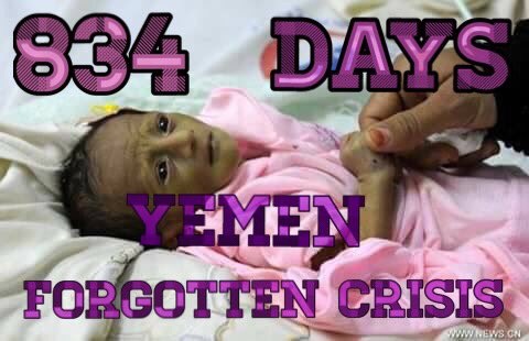 Yemeni_Proudly's tweet photo. Retweeted Wicked World (@WICKEDXWAYS1972):

#كلنا_اليمن #اوقفوا_حرب_اليمن  #TheStoryOfYemen https://t.co/EHH8TlC5dv https://t.co/IHmr8109As